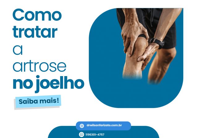 Saiba Como Tratar A Artrose No Joelho Dr Wilson Farizato Ortopedista Especialista Em Joelho